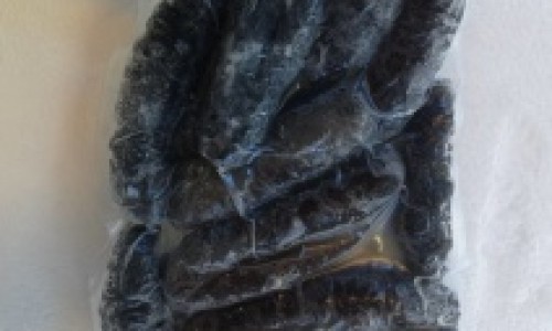 有结石的人需要注意些什么-权威有结石的人饮食方面要注意哪些平台,分享专业有结石平时生活上注意哪些知识_有结石怎么注意什么症状网
